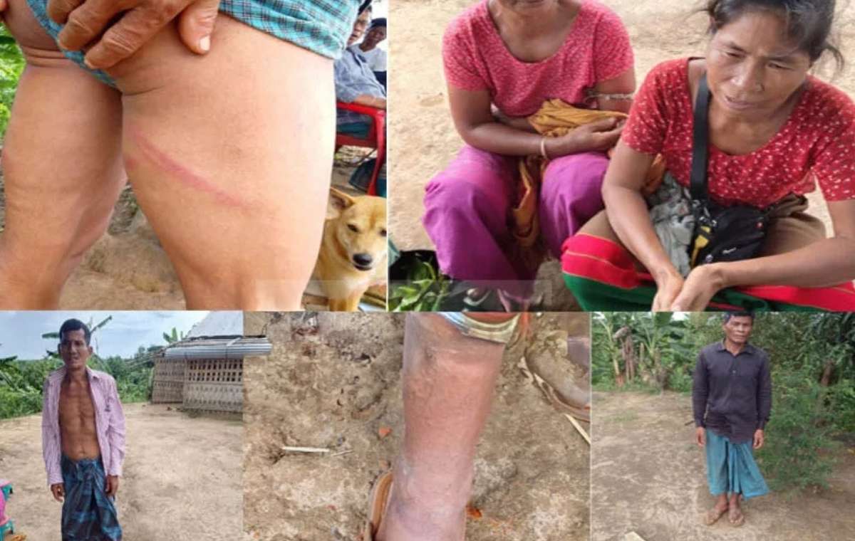 রামগড়ে বাজারে যাওয়ার পথে চাকমাদের ওপর হামলায় আহত ৬, মালামাল ও টাকা লুট