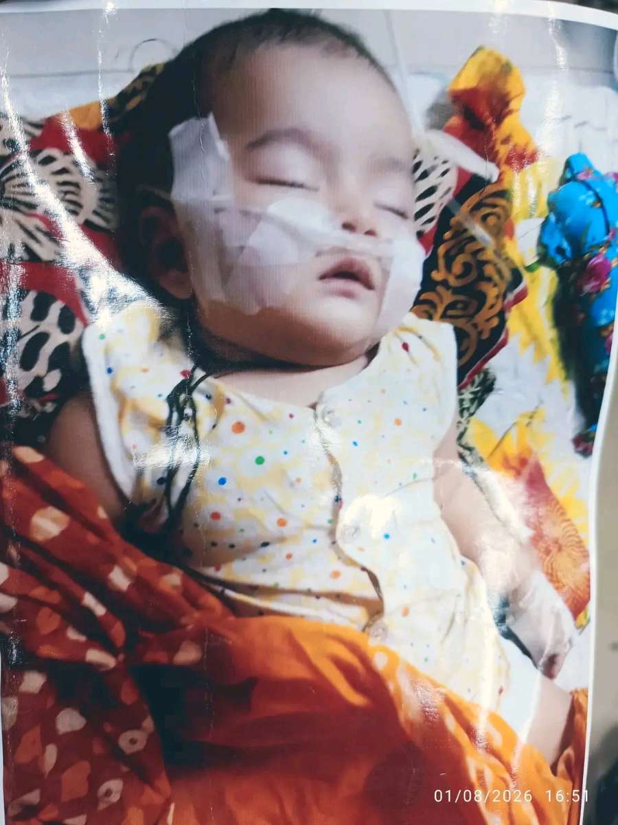 আপনার একটু সহযোগিতাই বাঁচাতে পারে চার মাসের শিশু জয়দীপের জীবন