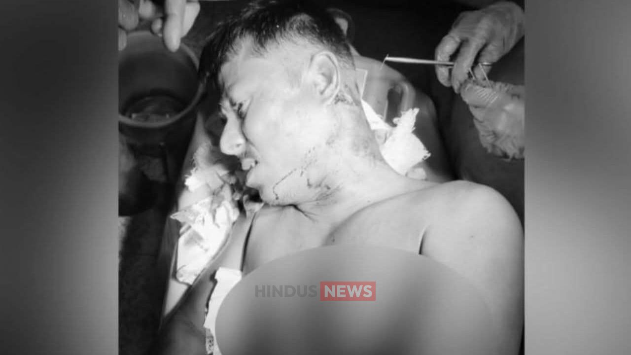 যশোরের ফতেপুরে দা দিয়ে ঘাড়ে কোপ, গুরুতর জখম শিবু বিশ্বাস